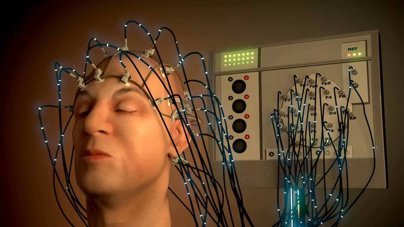 Опыты с вживлением электродов в головной мозг помогли многое о нем узнать