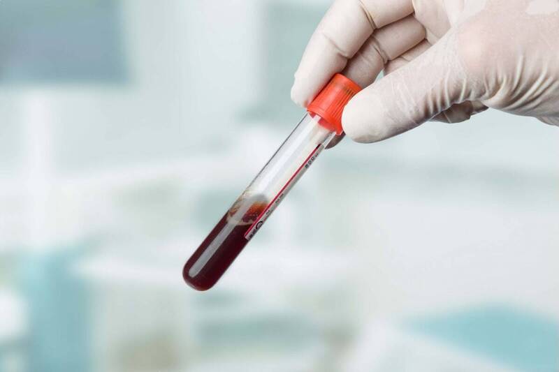 «Регулярное обследование на уровень глюкозы в крови – один из основных показателей состояния здоровья», – Наталья Тарадайко